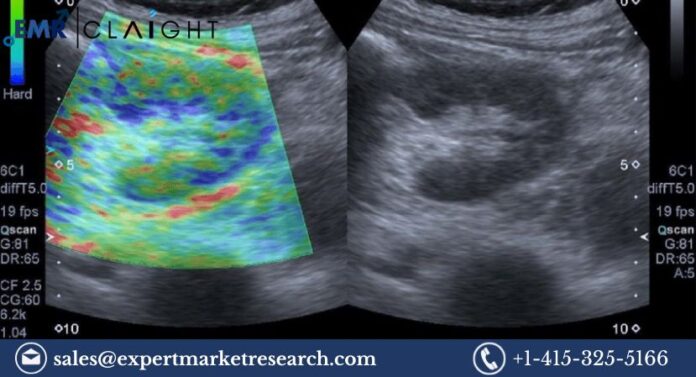 Elastography Imaging Market